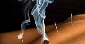 Acupuncture treatment with moxibustion therapy